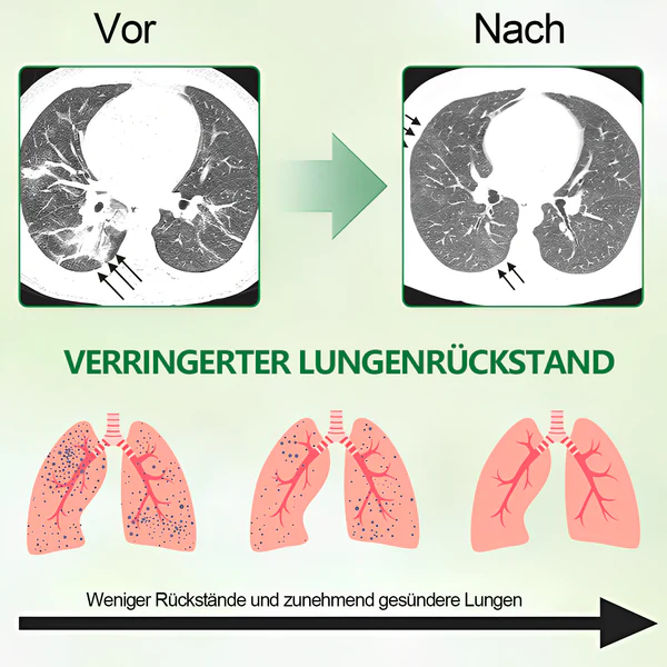 Lungenpflege-Inhalator | Sicherer und effektiver Weg zur Entgiftung der Lunge