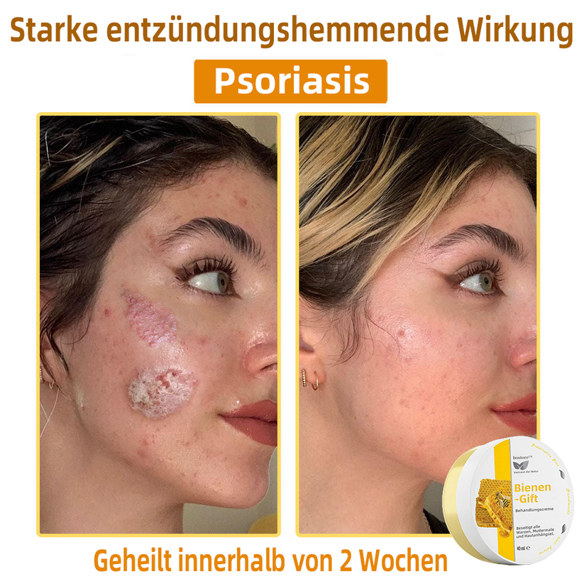 Bienengift-Therapie-Creme | Natürliche Hautlösung