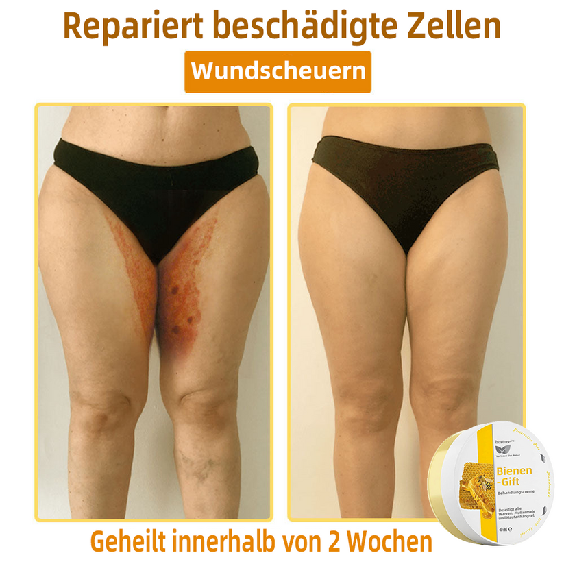 Bienengift-Therapie-Creme | Natürliche Hautlösung