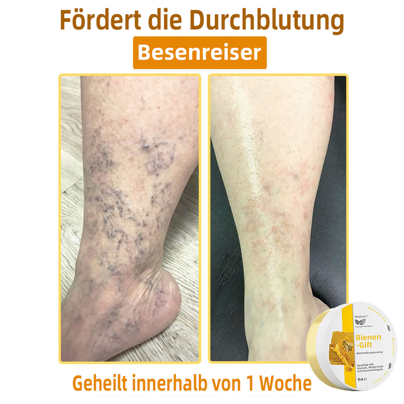 Bienengift-Therapie-Creme | Natürliche Hautlösung