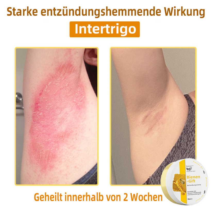 Bienengift-Therapie-Creme | Natürliche Hautlösung