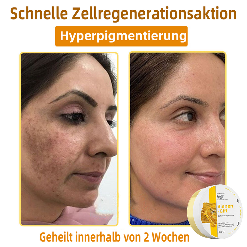 Bienengift-Therapie-Creme | Natürliche Hautlösung