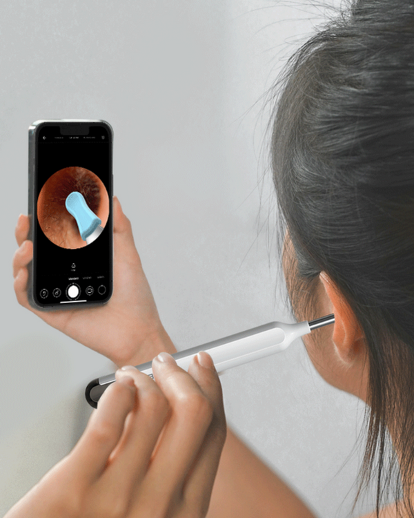 Intelligenter Ohrenreiniger | Sicher, Sanft, Effektiv