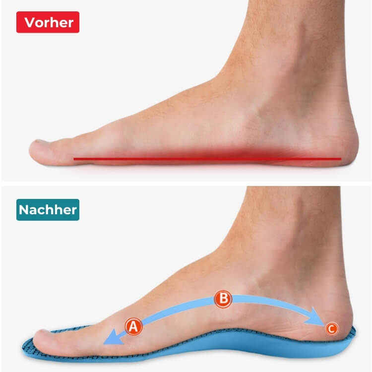 Fußeinlagen zur Schmerzlinderung | Hilft bei Plantarfasziitis & Neuropathie