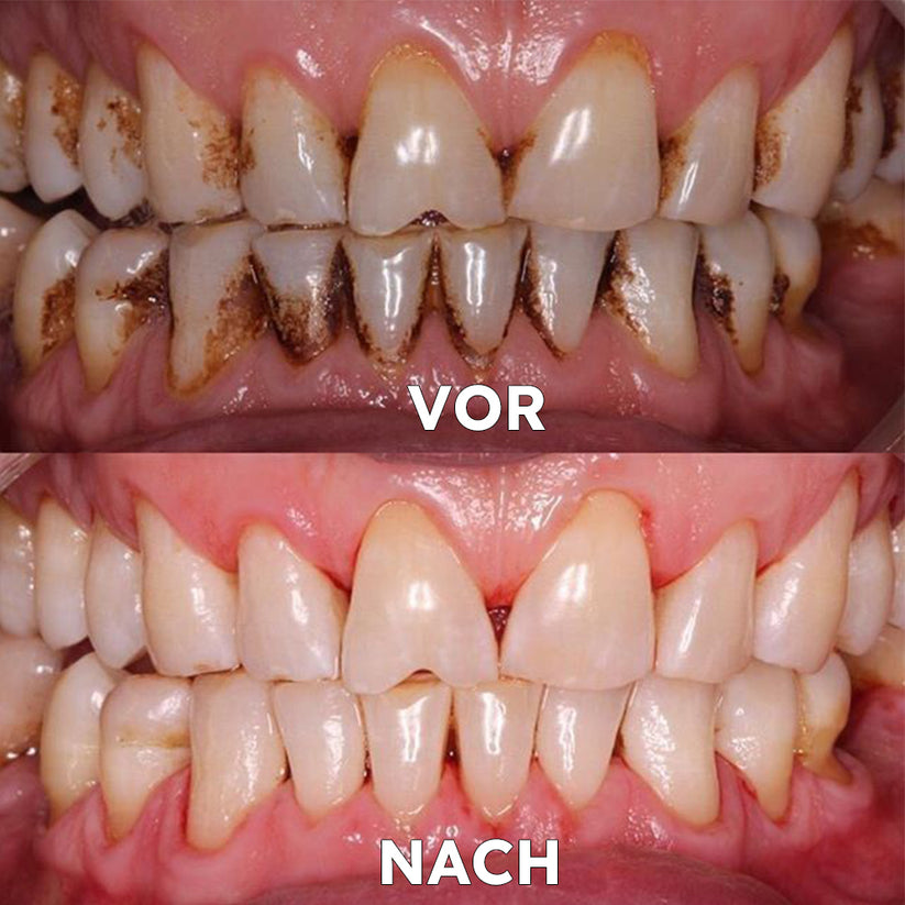 Zahnreparatur-Mineralpulver | Natürlich wiederherstellen & schützen