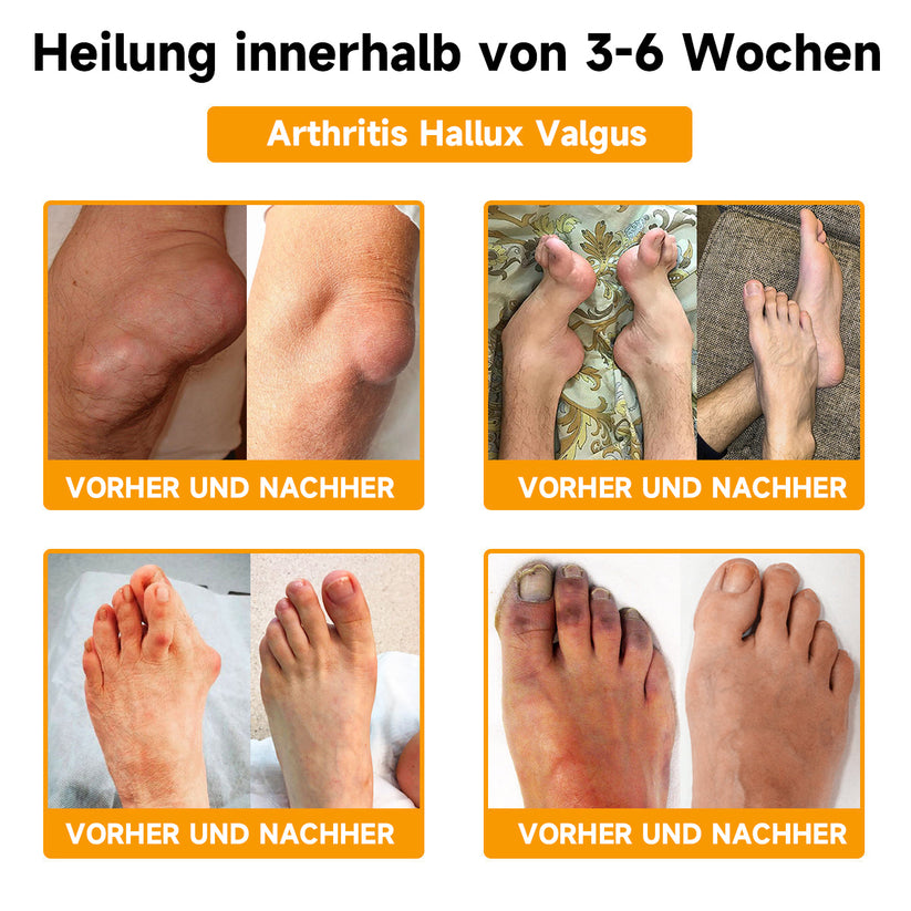 Bienen-Vital-Creme | Schnelle Schmerzlinderung - 1 + 1 Gratis!